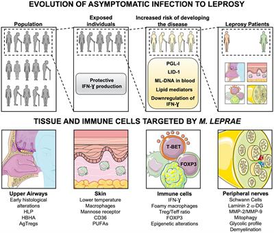 Modulation of the Response to Mycobacterium leprae and Pathogenesis of Leprosy